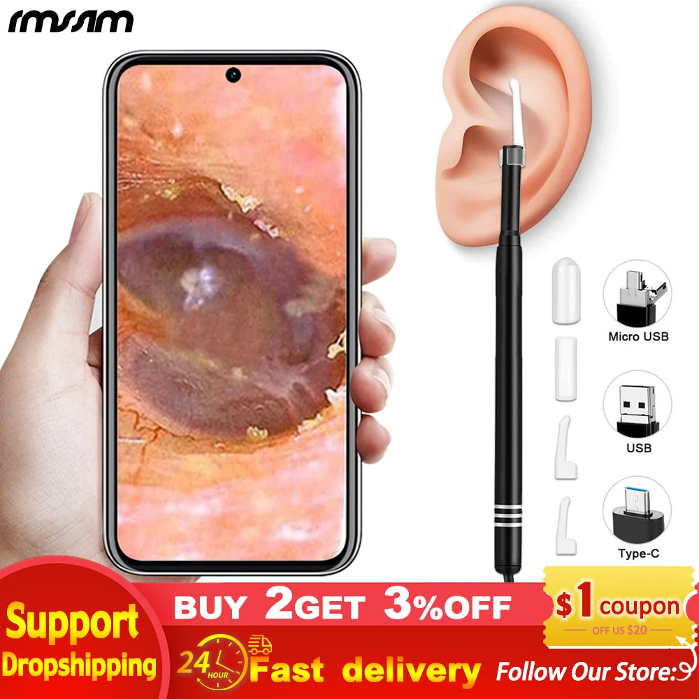 Smart Visual Medico Otoscopio Ear Cleaner Ear Endoscope Earpick Camera Ear Wax Remover Tool Ear Picker Ear Stick beleza e saude